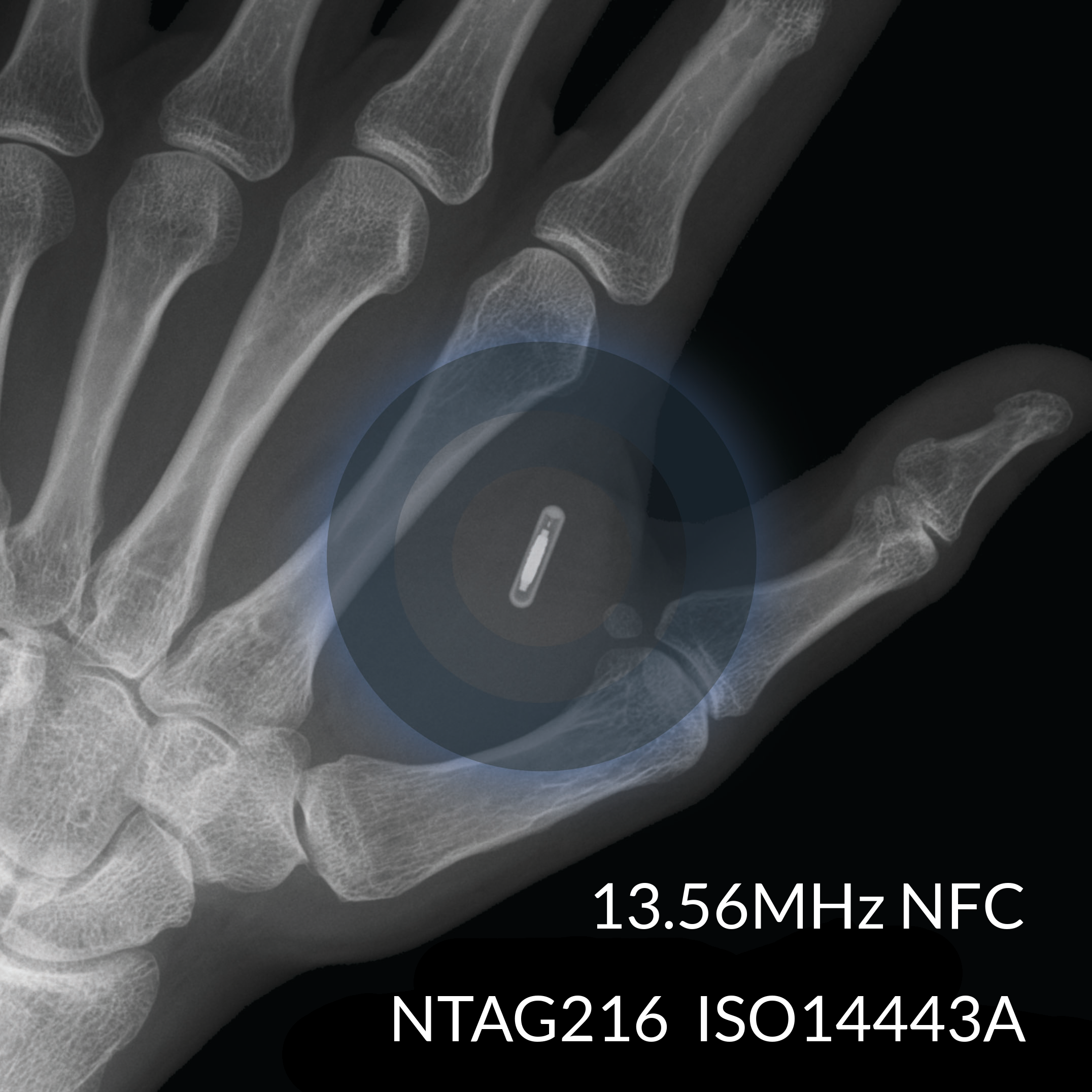 nfc implant, nfc implant Suppliers and Manufacturers at